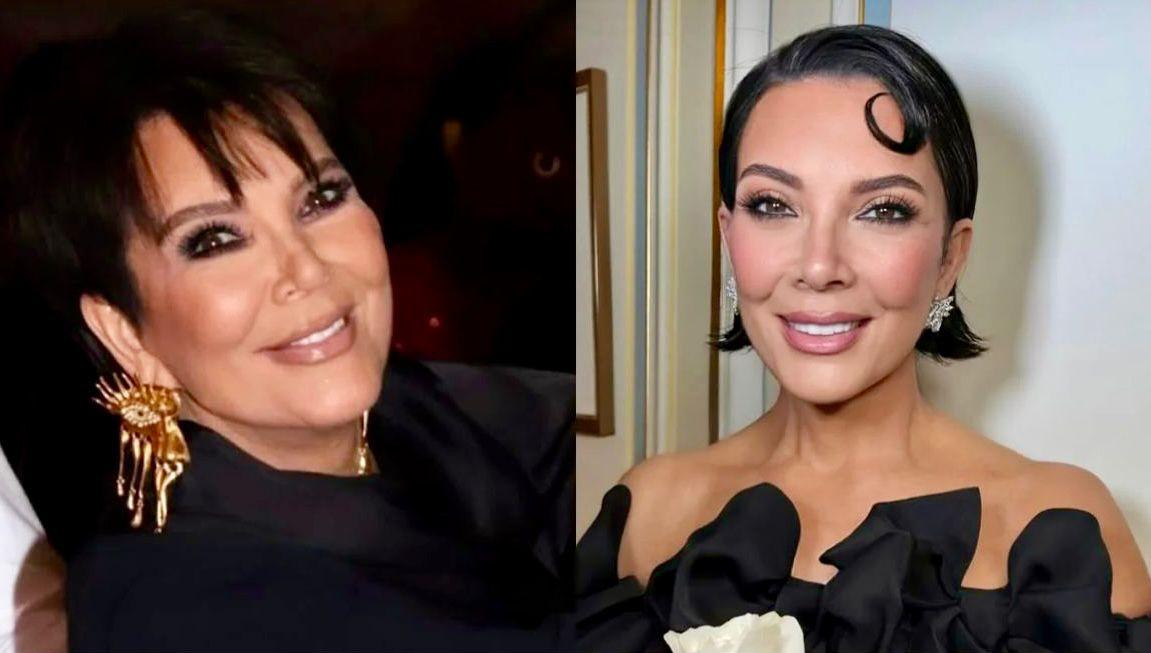 Cirurgião plástico baiano explica o efeito Kris Jenner - que rejuvenesce 20 anos em 10 dias com resultados naturais