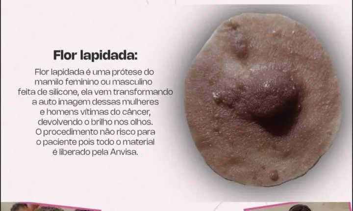 Poeta e Filé Modas promovem jogo beneficente em Paripe para ajudar pacientes com câncer